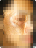 갈색균일타입