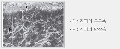 망상층